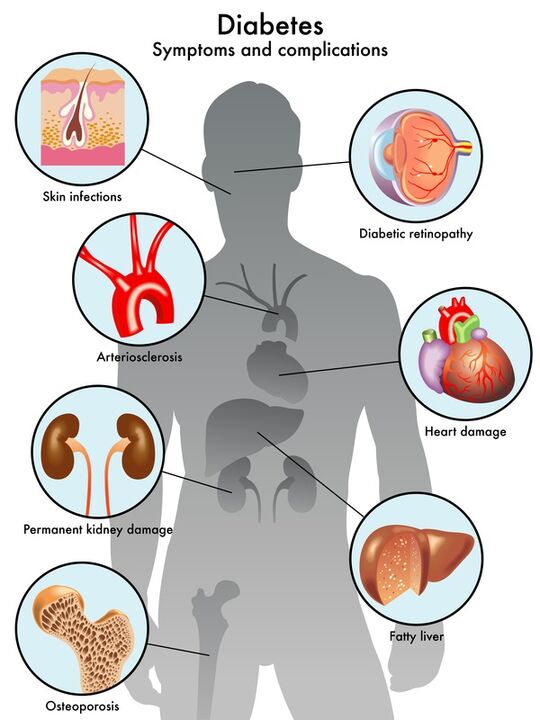 Insunol protects target organs against complications